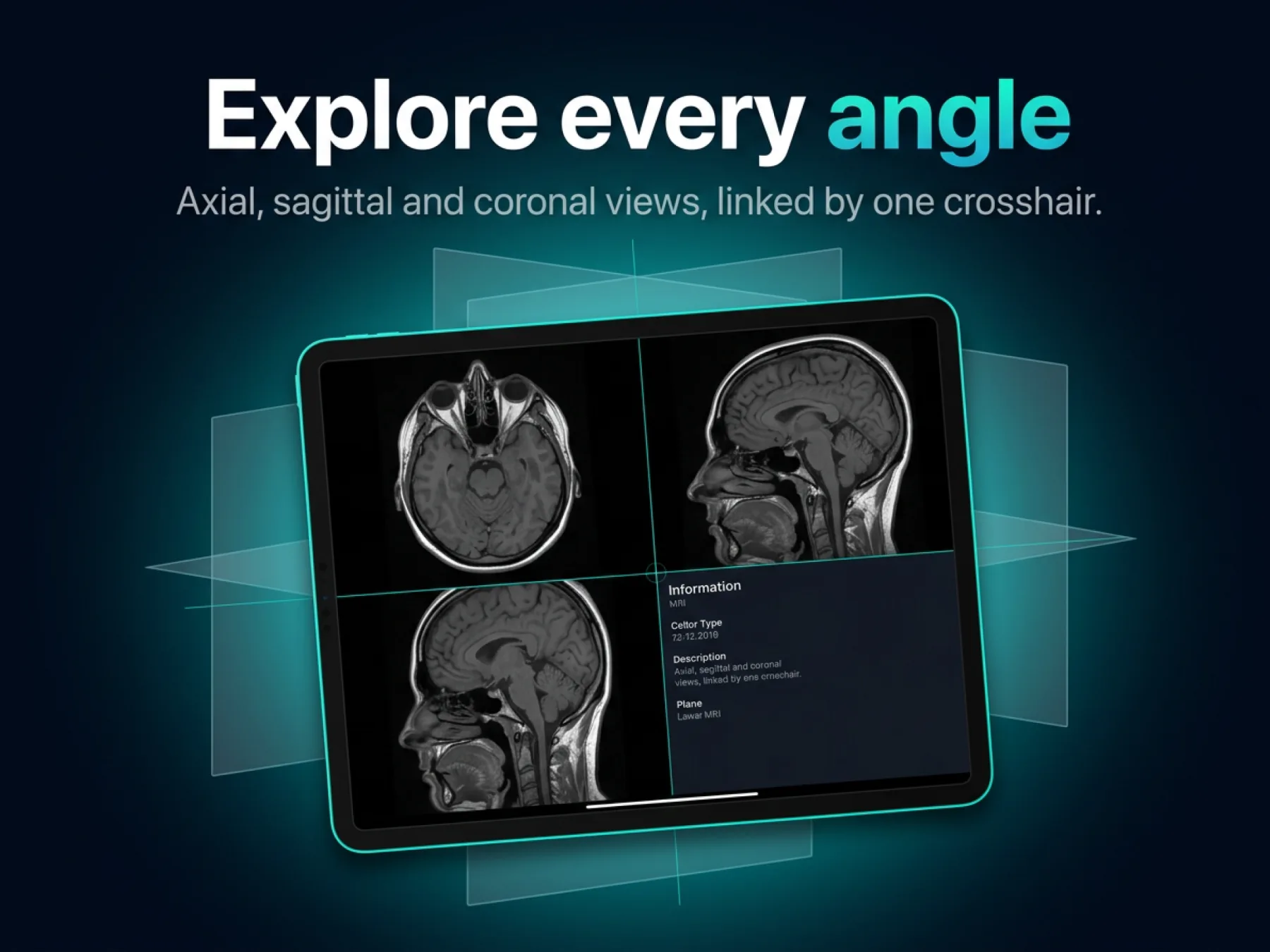 Slicora on iPad showing axial, sagittal and coronal MRI views linked by one crosshair
